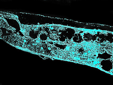 Syphilis bacterium. Treponema pallidum subsp pallidum on cultures of cotton tail rabbit epithelium cells Sf1Ep