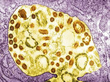 Electron micrograph of the Marburg virus. Marburg virus, first recognized in 1967, causes a sever type of hemorrhagic fever, which affects humans, as well as non-human primates.