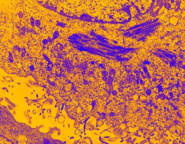 Ebola virus