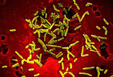 Scanning Electron Micrograph of Mycobacterium chelonae.