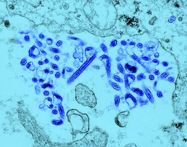 Ebola Virus viewed under TEM. Ebola virus is a RNA virus. It is responsible for severe hemorrhagic fever.