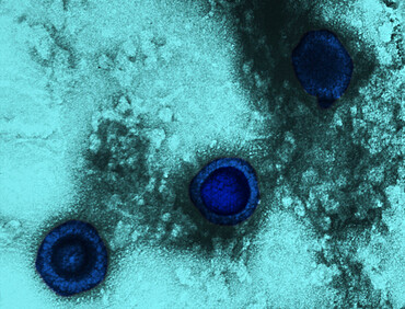 This transmission electron micrograph from a pelleted specimen depicts three icosahedral-shaped herpes virus virions. The staining technique used to process this specimen revealed the following findings: virions with a dark center, where the stain has pen