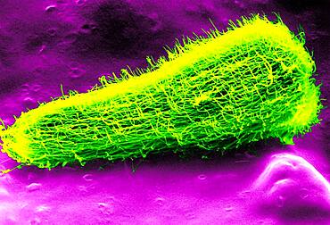 Miracidium larva of the liver fluke (fasciola hepatica) viewed in SEM.