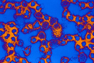 La crosse virus