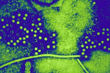 Hepatitis e virus