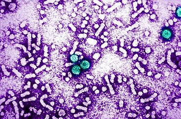 Hepatitis b virus