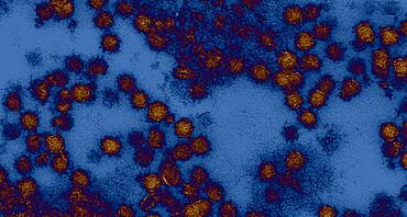 West nile virus