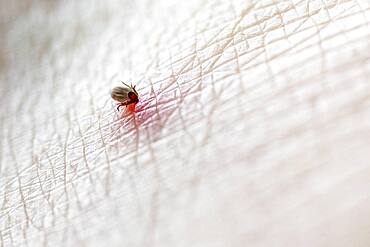 Castor Bean Tick (Ixodes ricinus), tick on human skin, tick bite