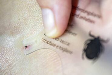 Castor Bean Tick (Ixodes ricinus), tick on human skin, tick bite, removal by tick card