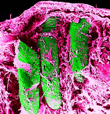 Transversal section of the colon. SEM x 150.