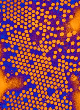 Electron micrograph of the poliovirus. Poliovirus is a species of Enterovirus, which is a genus in the family of Picornaviridae, and is an RNA virus.