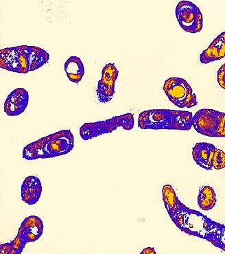 Transmission electron micrograph of Bacillus anthracis.