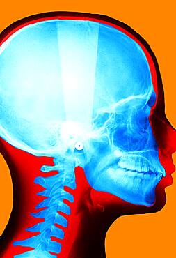 X-ray of the skull.