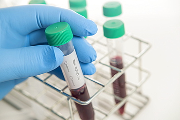 Close-up of hand in surgical glove holding blood sample