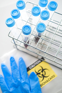 Blood samples with biohazard sign and surgical glove