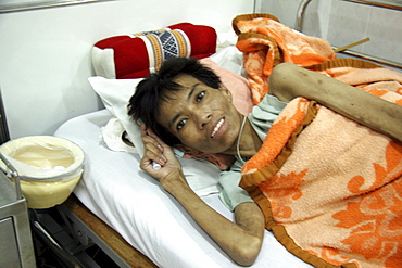 Thailand hiv+ patients in an aids hospice at a buddhist temple in lopburi