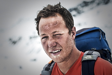 A climber at Everest Base Camp the day after he has successfully summited Everest showing signs of exposure at high altitude, Khumbu Region, Nepal, Asia