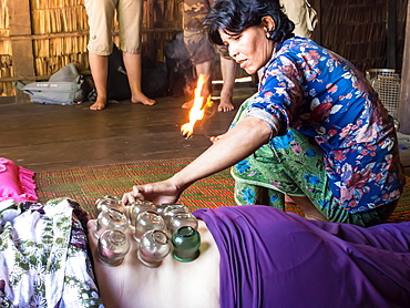 Traditional healing technique of fire cupping, village near Siem Reap, Cambodia, Indochina, Southeast Asia, Asia