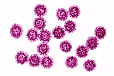 Coronavirus