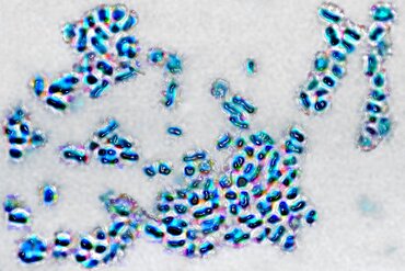 Prevotella bacteria