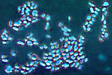 Prevotella bacteria