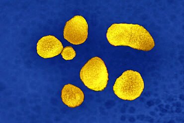 Prevotella bacteria