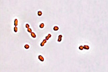 Streptococcus agalactiae