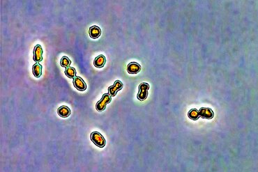 Streptococcus agalactiae