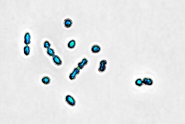 Streptococcus agalactiae