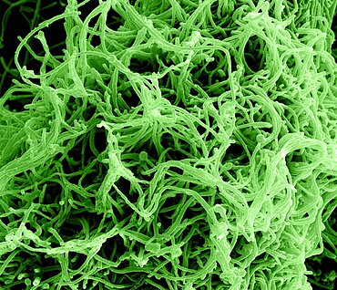 Ebola virus particles