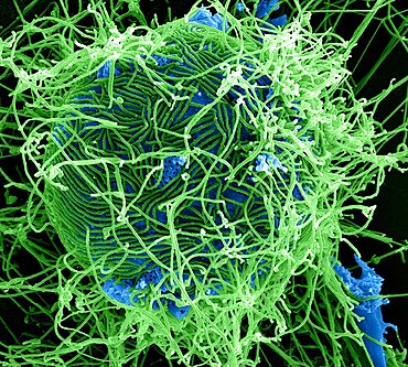 Ebola virus particles