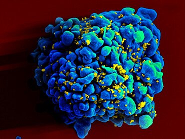 Hiv-infected h9 t cell