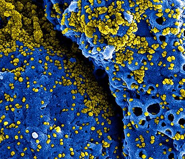 Mers coronavirus particles