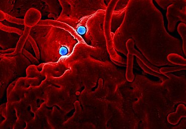 Mers coronavirus particles