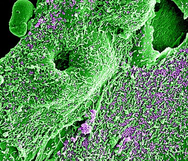 Mers virus particles