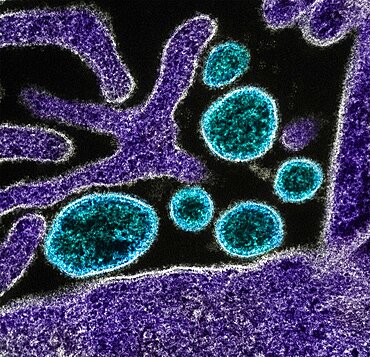 Nipah virus particles