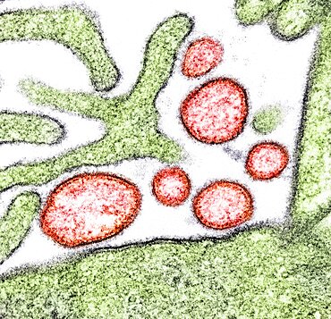 Nipah virus particles