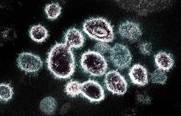 Novel coronavirus sars-cov-2