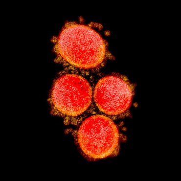 Novel coronavirus sars-cov-2