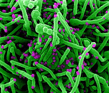 Novel coronavirus sars-cov-2