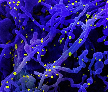 Novel coronavirus sars-cov-2