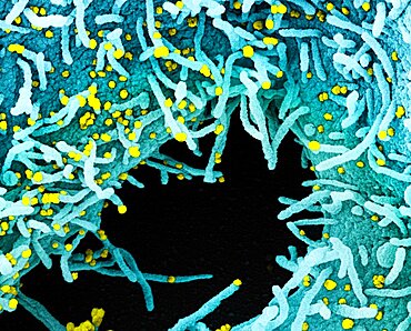 Novel coronavirus sars-cov-2