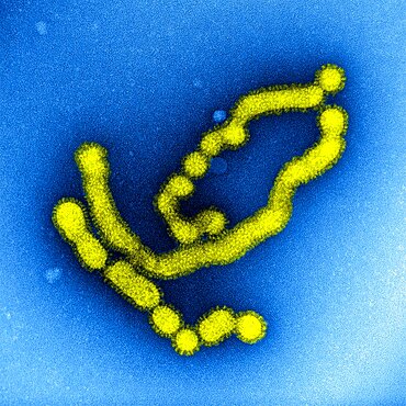 Swine flu strain virus particles