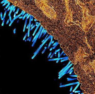 Swine flu virus particles