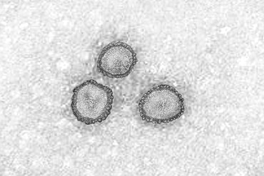 Coronavirus, virus of the family Coronaviridae and of the subfamily Orthocoronavirinae. View from a transmission electron microscopy (TEM) image