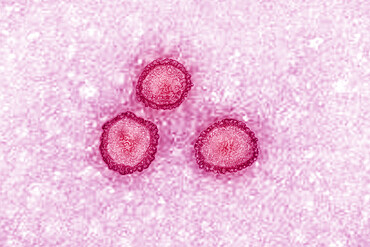 Coronavirus, virus of the family Coronaviridae and of the subfamily Orthocoronavirinae. View from a transmission electron microscopy (TEM) image