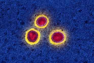 Coronavirus, virus of the family Coronaviridae and of the subfamily Orthocoronavirinae. View from a transmission electron microscopy (TEM) image