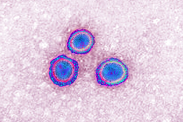 Coronavirus, virus of the family Coronaviridae and of the subfamily Orthocoronavirinae. View from a transmission electron microscopy (TEM) image