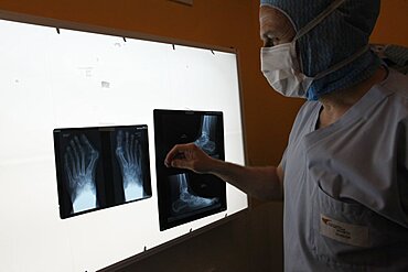 Hallux Valgus, X-ray