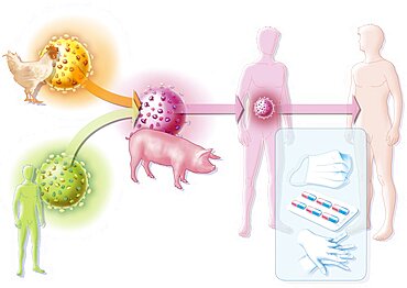 Influenza A H1N1 Infection